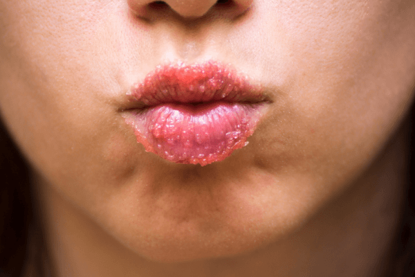 Emulsified Lip Scrub