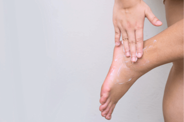 YUMI Feet | Cracked Heel Treatment for Pedicure in Singapore, Hong Kong,  Philippines